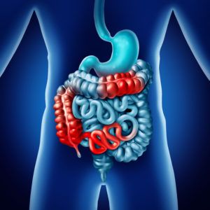 Living with Crohns Disease: Tips and Treatments